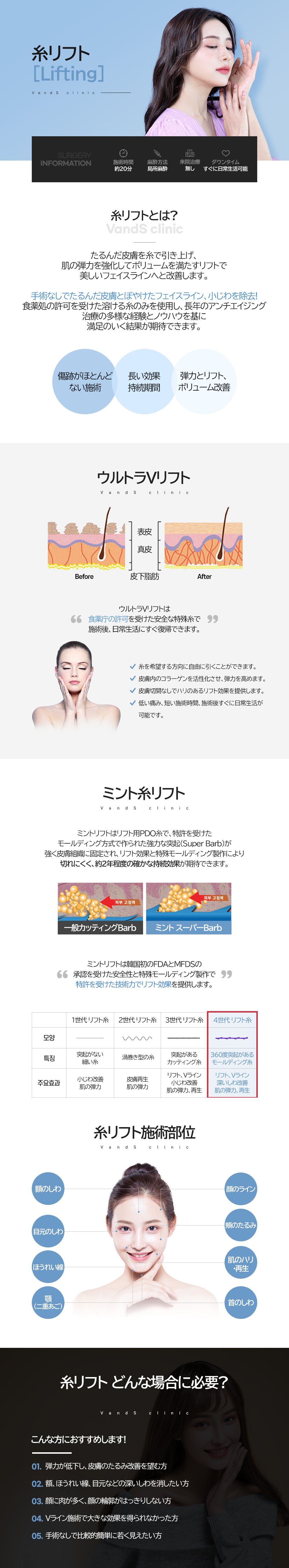 糸リフト 施術案内画像1