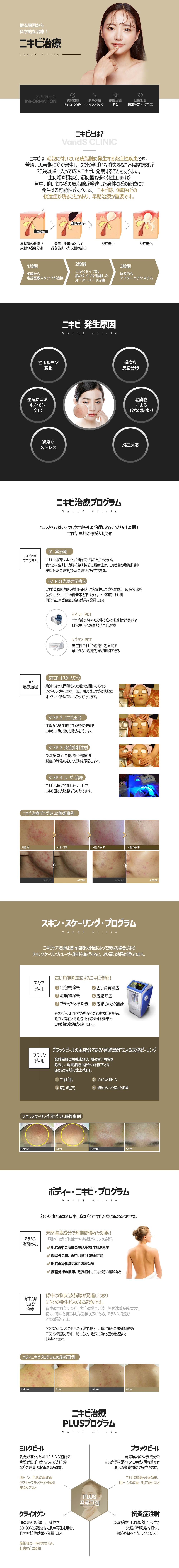 ニキビ治療 施術案内画像1